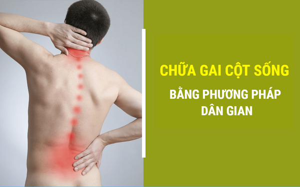 3 BÀI THUỐC DÂN GIAN CHỮA GAI CỘT SỐNG LÀNH TÍNH, HIỆU QUẢ NHẤT
