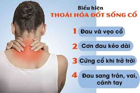 Thoái hóa đốt sống cổ gây TÊ TAY hãy "thận trọng"